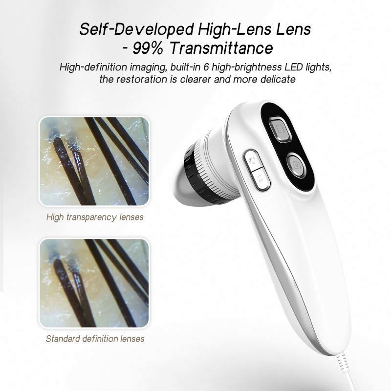 HD Hair Follicles Hair Scanner Scalp Detector Skin Analyzer Scalp Analysis Machine Skin Analysis Detector Beauty Salons