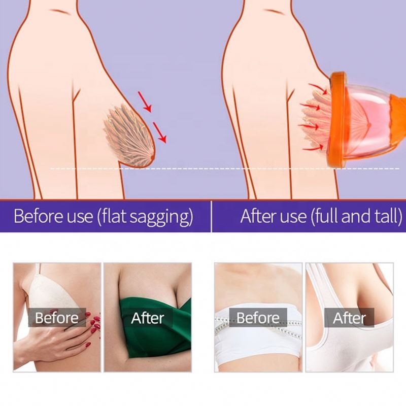 2025  Newest Vacuum Suction Cup Therapy Vacuum Butt Lifting Breast Enhancement Buttocks Enlargement Machine