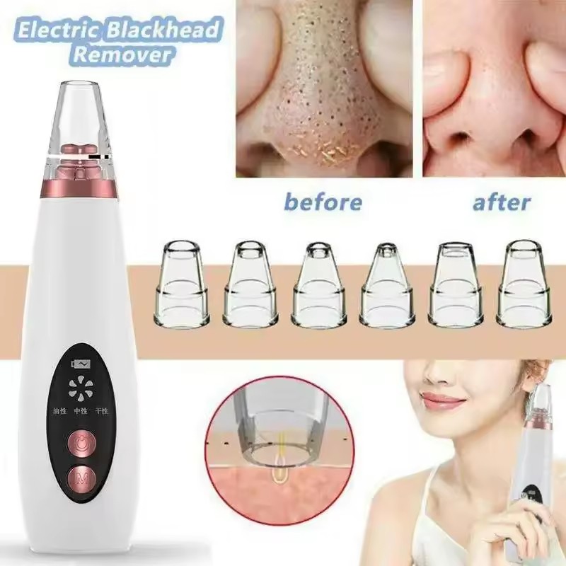 Factory Price Blackhead Remover Pore Nose Cleaning Vacuum Electric Blackhead Remover Cleaner