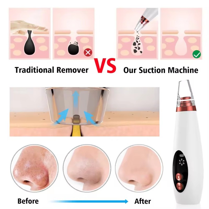 Face Cleaning Acne Removal Kit Electric Facial  Nose Blackhead Remover Pore Vacuum Cleaner Pore Cleaner Electric Vacuum Pore