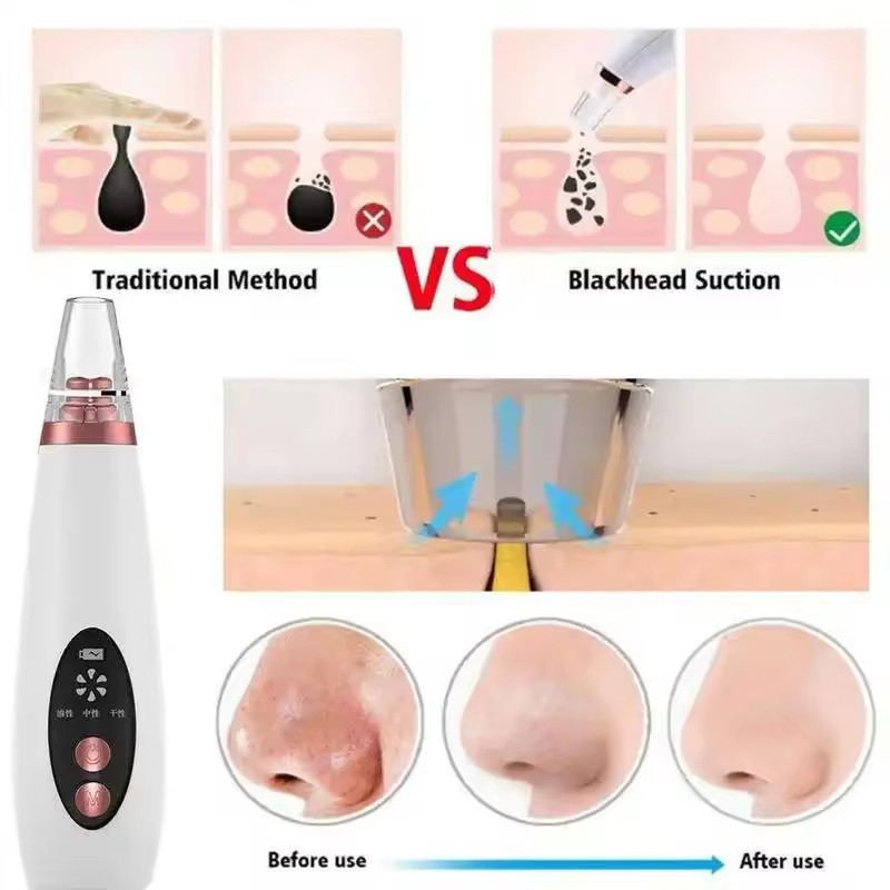 Factory Price Blackhead Remover Pore Nose Cleaning Vacuum Electric Blackhead Remover Cleaner