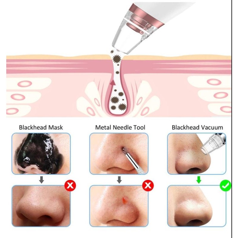 Best Selling Adjustable Suction Force Electric Acne Remover Comedone Extractor Kit USB Rechargeable Blackhead Vacuum