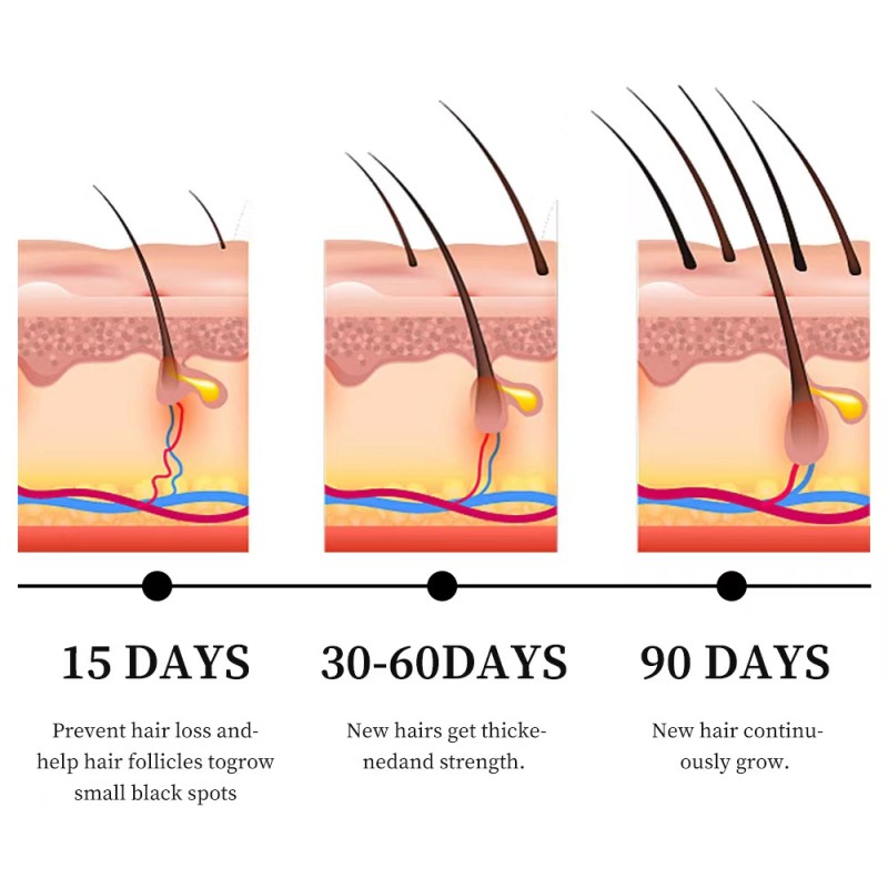 Private Label Organic Hair Repair Promote Growth Scalp Treatment Anti-itch Hair Scalp for Hair Growth