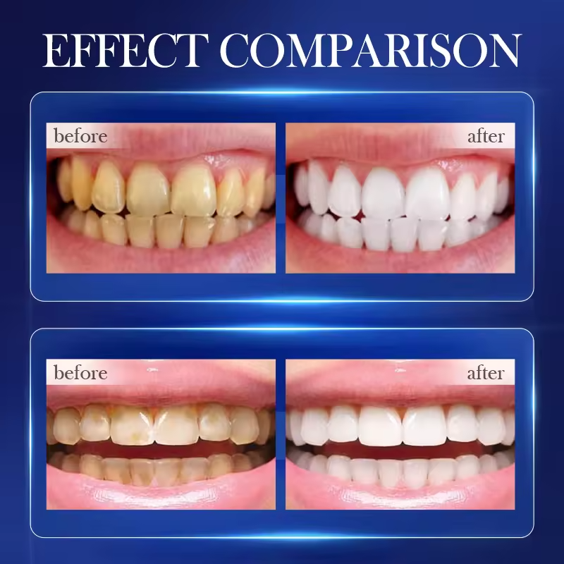 Private Label SADOER Baking Soda Toothpaste Cleaning Teeth Whitening Probiotics Mint Toothpaste Whiten Teeth Oral Care