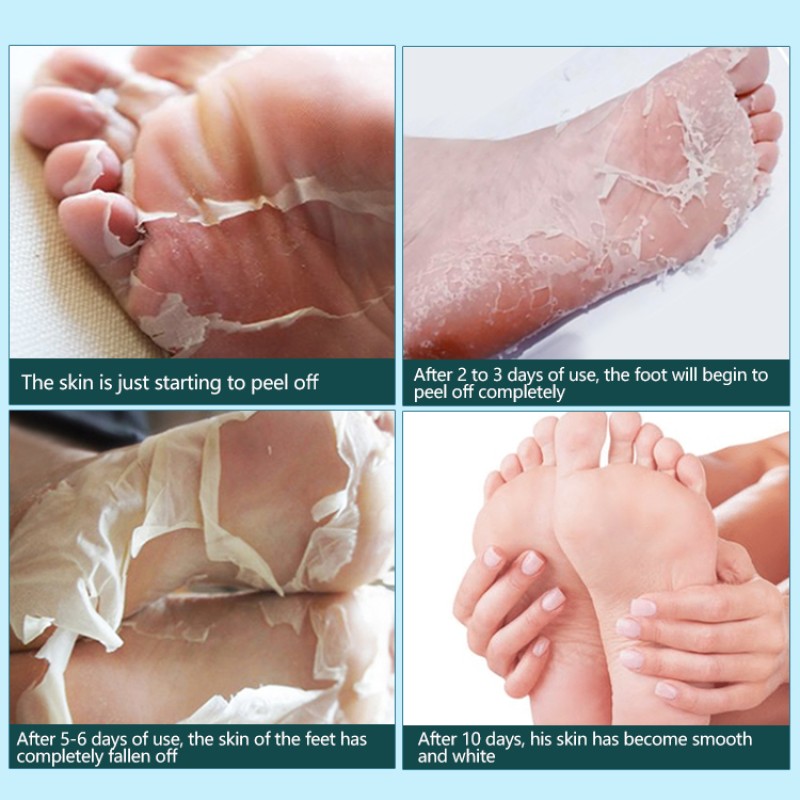OEM Private Label Organic Removal Calluses Crack Moisturizing Natural Peeling Exfoliating Coconut Foot Peel Mask