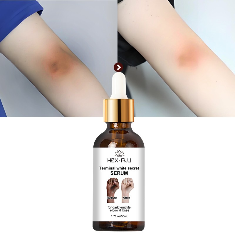 Fast Shipping 50ml Fast Whitening Serum for Dark Knuckles - Intense Pigmentation Remover for Hands Elbows and Knees