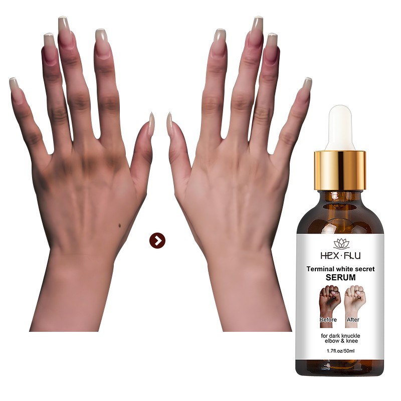 Dark Knuckles Fast Whitening Serum Pigmentation Hand Knuckle Elbows Knee Intense Stains Remover Serum