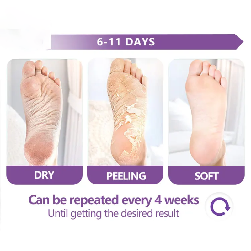 Custom logo Exfoliating Scrub Pedicure Spa Socks Foot Peel Mask Feet Care for Heels Remove Dead Skin Moisturizing Foot Mask