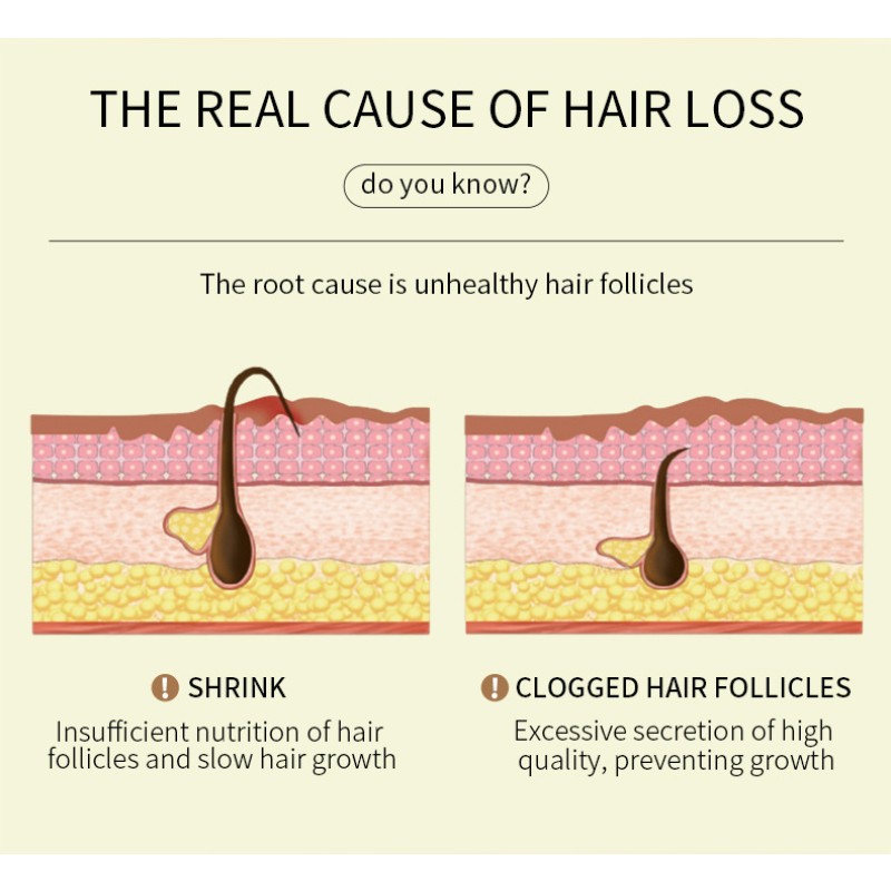 Hair Essential Oil Promoting Rosemary Hair Growth Serum Natural Plant Oil Nourish Repair Anti Loss Hair Serum Product