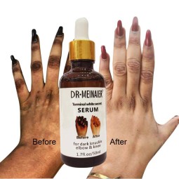 Dark Knuckles Fast Whitening Serum Pigmentation Hand Knuckle Elbows Knee Intense Stains Remover Serum