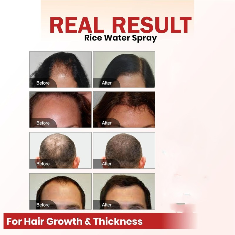 Factory Oem Thicker Nurturing Scalp Castor Oil Batana Oil Rosemary Oil Hair Growth Spray Hair Growth Serum Hair Serum