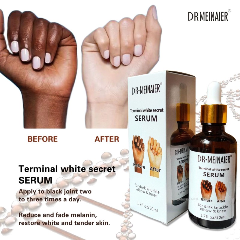 Dark Knuckles Fast Whitening Serum Pigmentation Hand Knuckle Elbows Knee Intense Stains Remover Serum