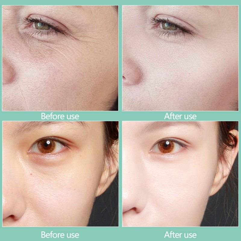 Hot Sale Glitter Eye Mask Remove Dark Circle Collagen Eye Cooling Patch Hydrogel Herbal Under Eye Patches