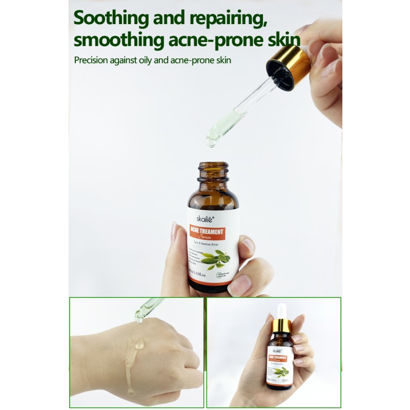 Organic Plant Extract Skin Whitening and Moisturizing Tea Tree Essence Oil Face Anti-Acne Control Pore-Glow Face Essence