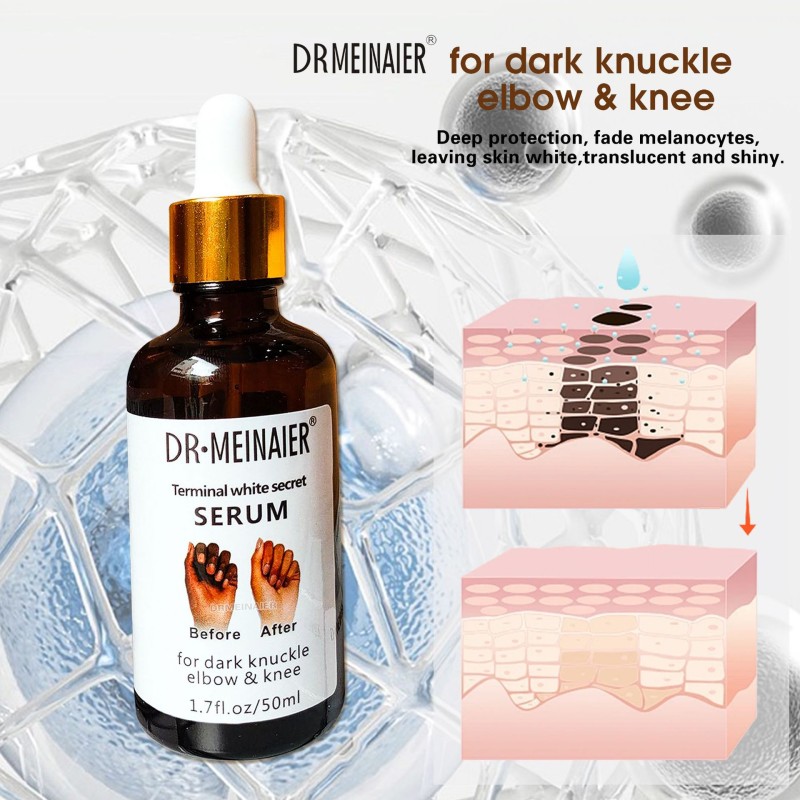 Dark Knuckles Fast Whitening Serum Pigmentation Hand Knuckle Elbows Knee Intense Stains Remover Serum