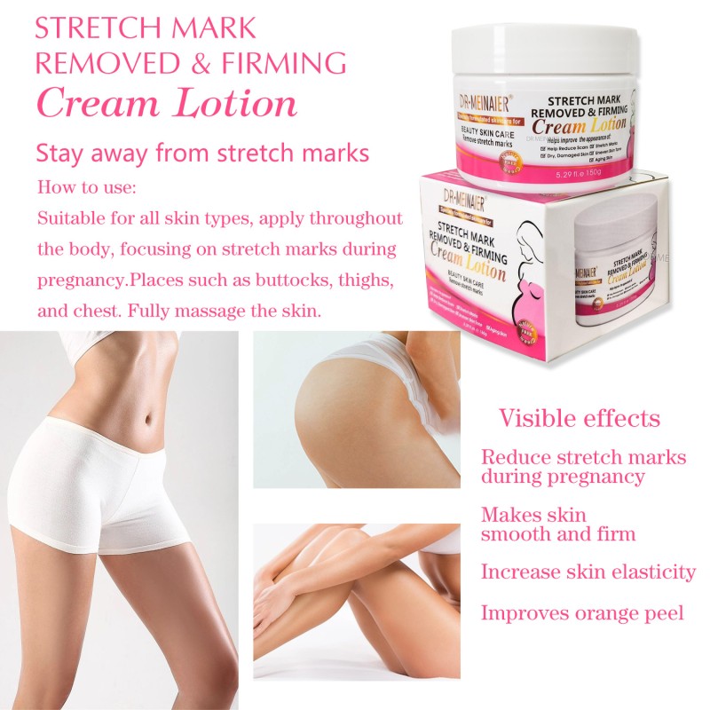 Source Manufacturer: Stretch Mark Lightening Cream, Pregnant Women Repair Scars, Obesity Lines Firming Massage Cream