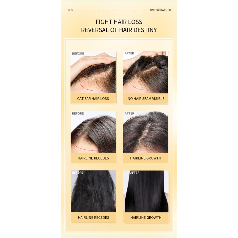 Hair Essential Oil Promoting Rosemary Hair Growth Serum Natural Plant Oil Nourish Repair Anti Loss Hair Serum Product