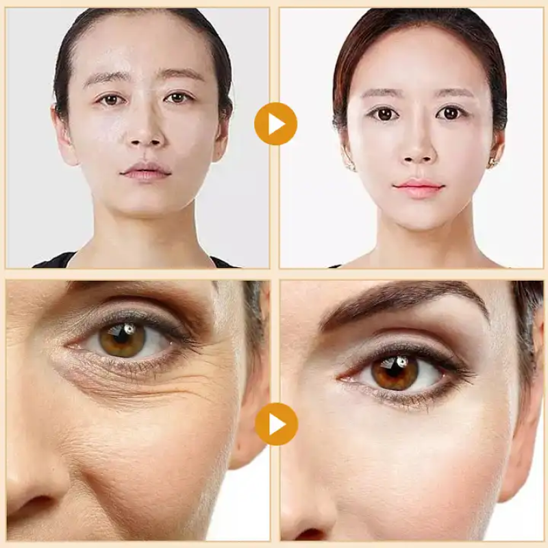 Oem Private Label No Needle Water Soluble Removal Dissolving Absorbable Collagen Golden Protein Threads for Face Lifting