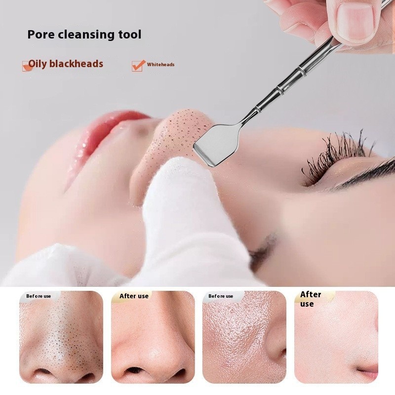 Special Artifact Double-Headed Manual Blackhead Scraper Nose Pore Cleaning Makeup Tool for Acne Scavenging Black Color