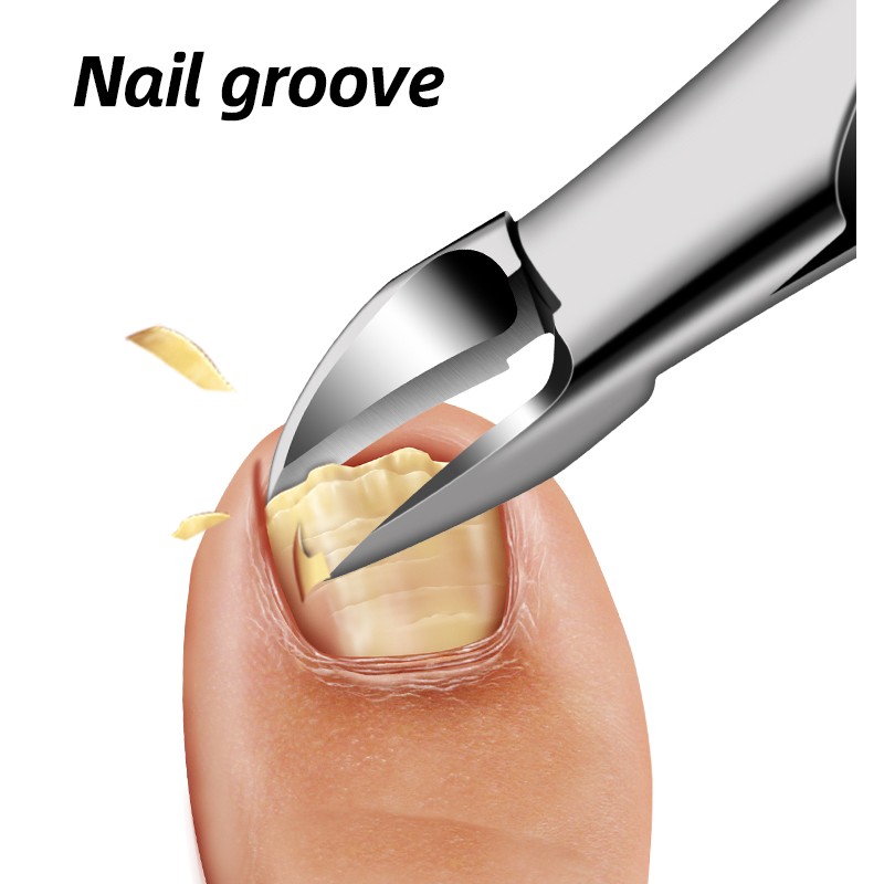 Large Olecranon Nail Clippers From Manufacturers Pedicure Pliers With Steel Groove for Ingrown Nail Treatment for Fingers Toes