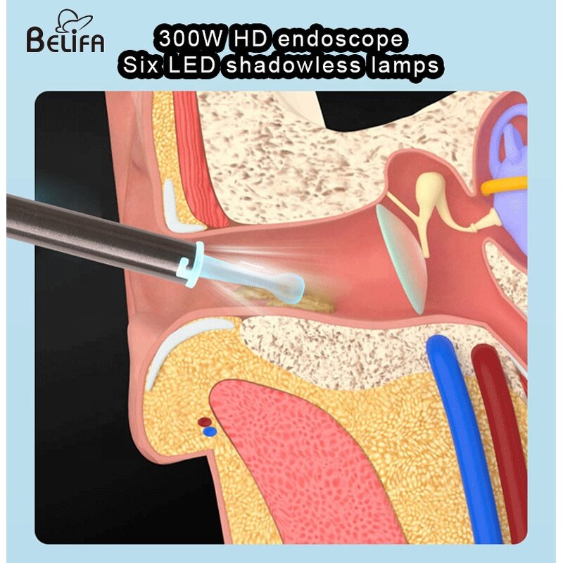 Ear Wax Cleaner Manufacturer - OEM/ODM Wireless Electric Endoscope with Camera