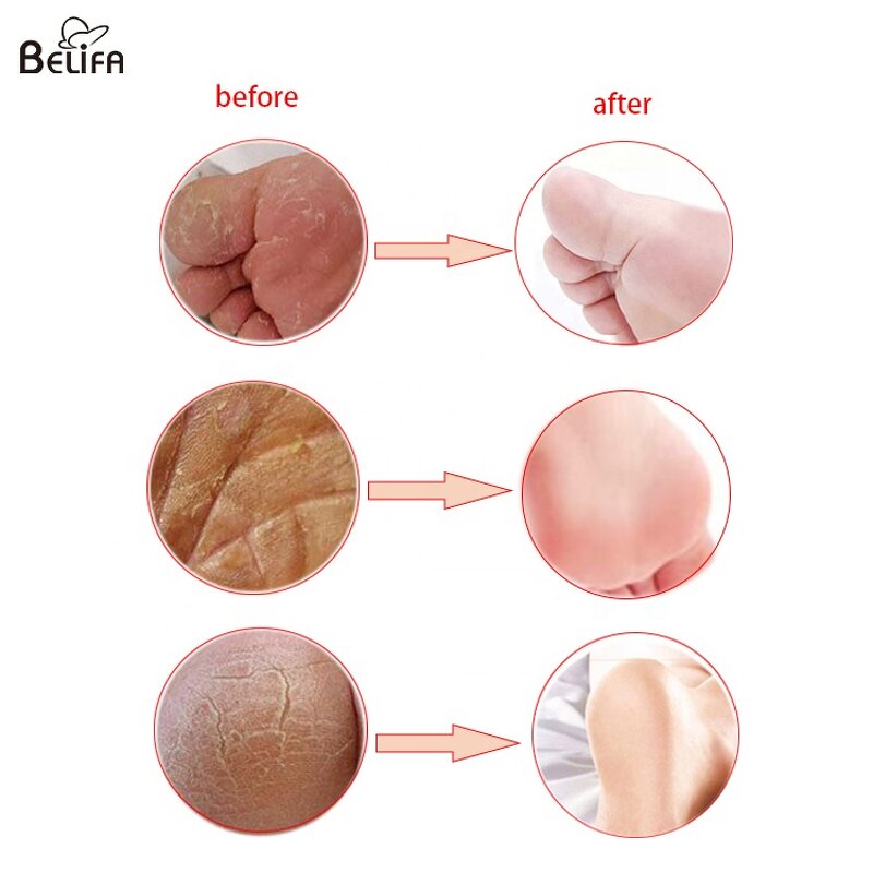 Electric Pedicure File Manufacturer - OEM/ODM Rechargeable Foot Scrubber Callus