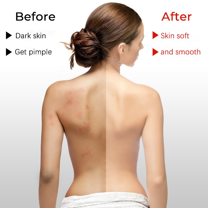 Body Scrub Manufacturer - Wholesale Natural Whitening Exfoliating Organic