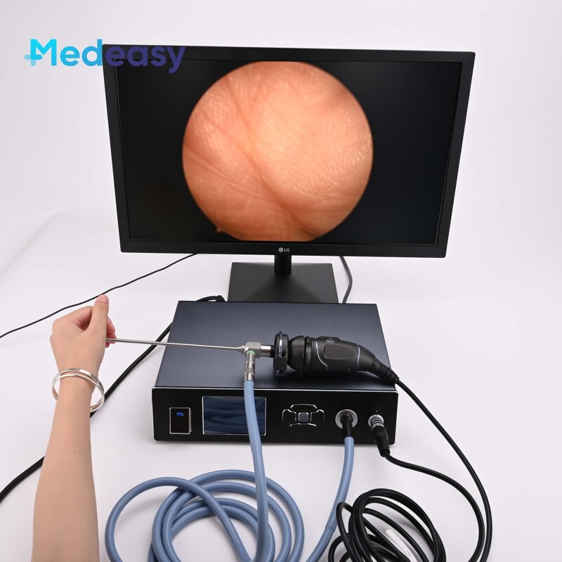 Medical Endoscopy Camera System Supplier - 1080P 60FPS Full HD with Light Source