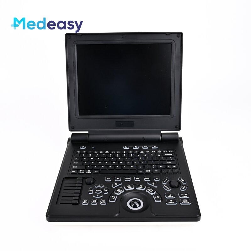 Portable Ultrasound Supplier - New Type Laptop Doppler Test Diagnostic