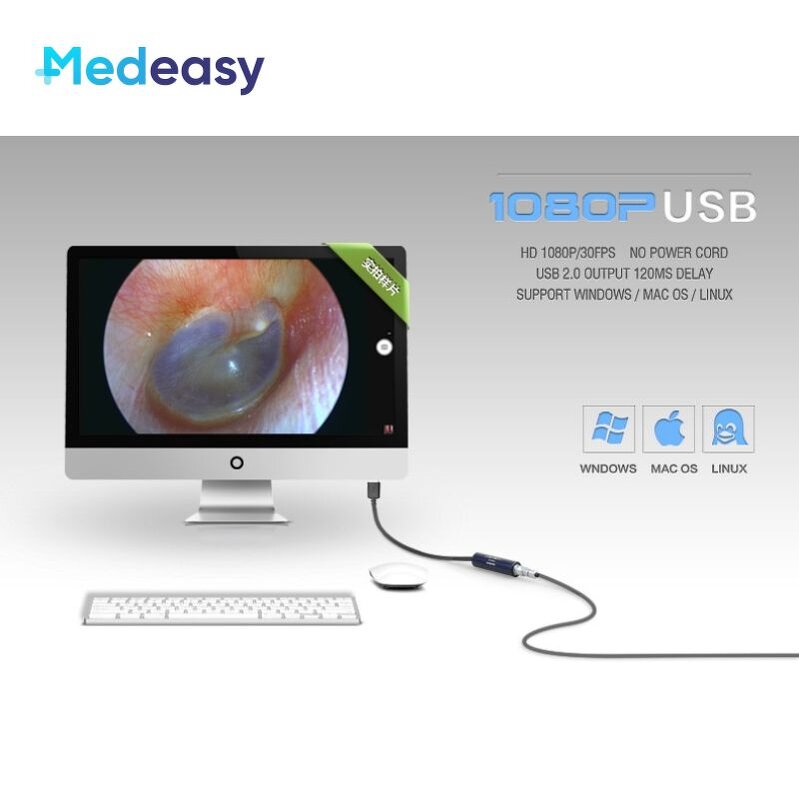 Medical USB Endoscope Camera Supplier - Waterproof for ENT Surgery