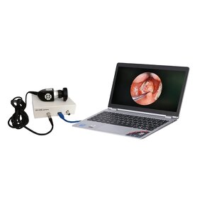 Multi-output Endoscope Camera Manufacturer - Medical Full HD 1080P USB