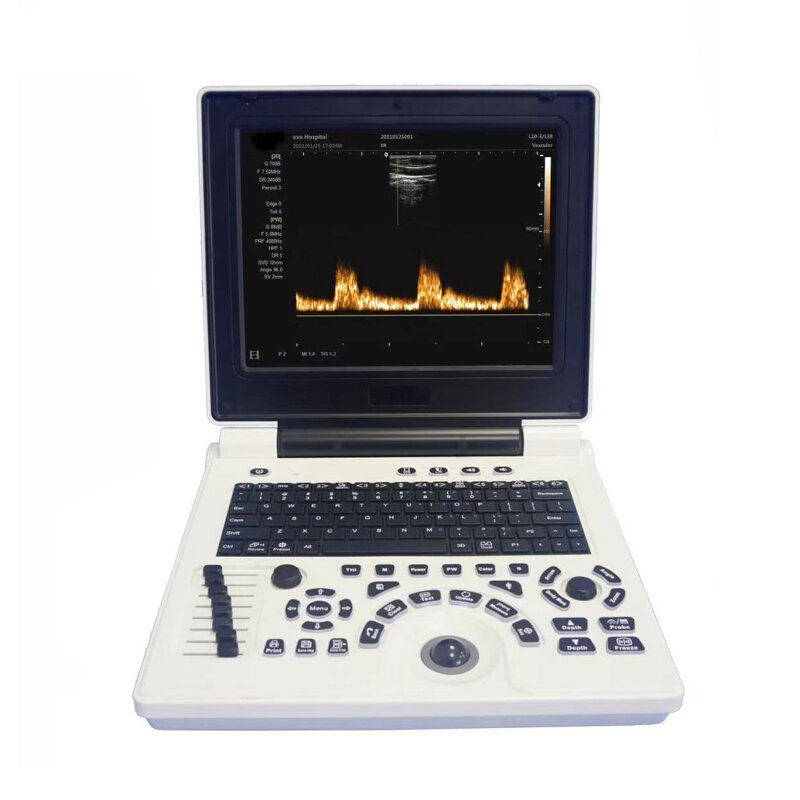 Laptop Ultrasound Scanner Factory - New B/W Device Portable with PW/ IMT