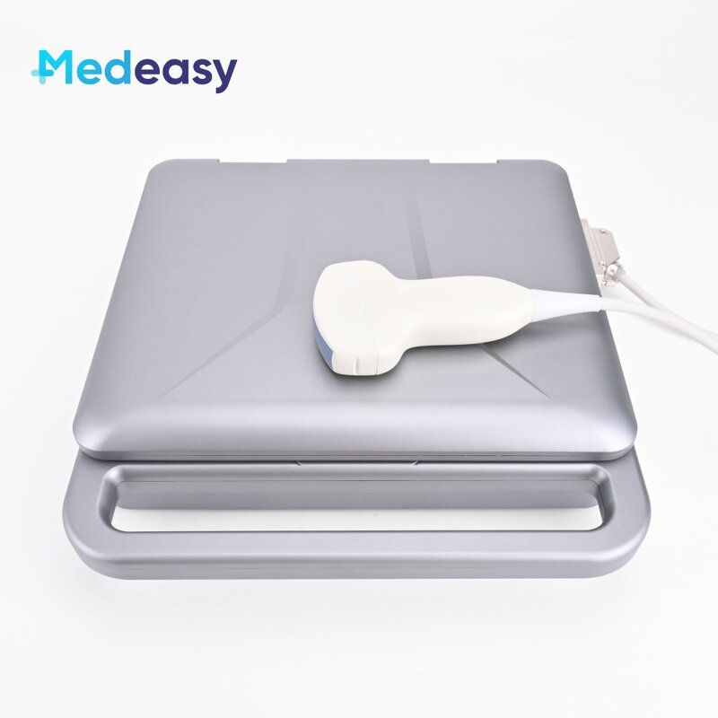 Handheld Ultrasound Scanner Factory - 12 Inch White Black Device with Probe