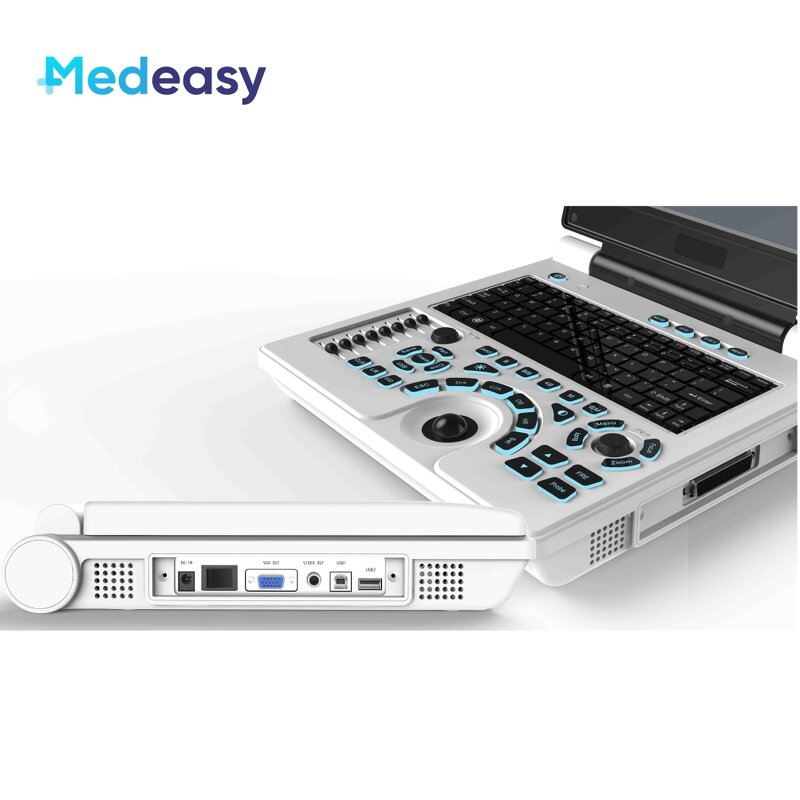 Portable Wireless Ultrasound Manufacturer - Hot Selling Mini 2 in 1 Custom