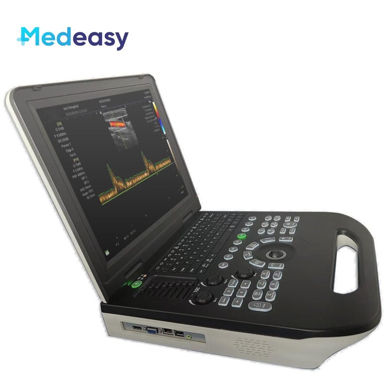 Color Doppler Ultrasound Factory - Portable 3D Image Pregnancy Diagnostic