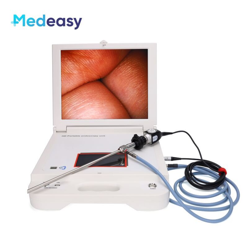 Medical Monitor Endoscopy Unit Manufacturer - 17 Inch Recorder LED Light HD