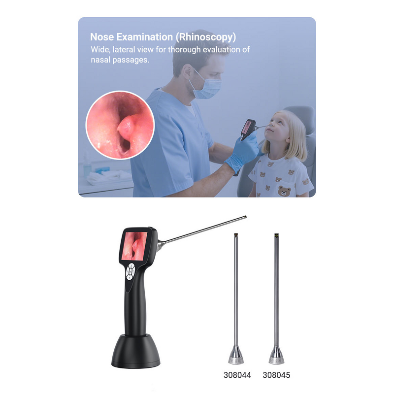 Portable Ent Endoscope Video Otoscope Manufacturer - Digital Visual Ear Camera
