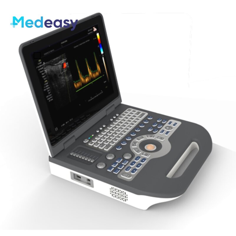Color Doppler Ultrasound Scanner Supplier - Mindray 4d Portable Attractive Price