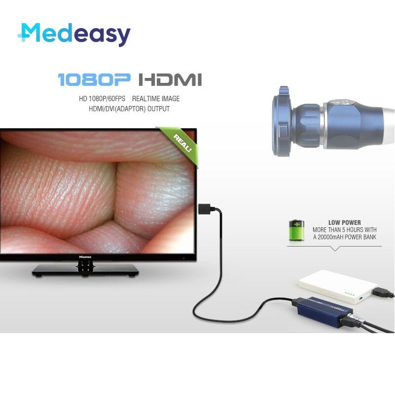 Medical USB Endoscope Camera Supplier - Waterproof for ENT Surgery