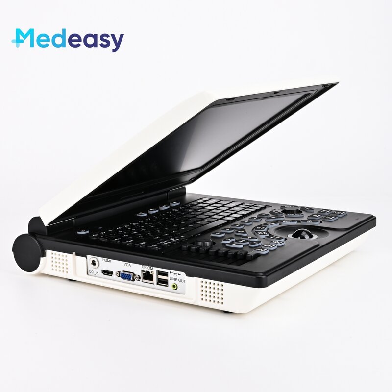 Portable Ultrasound Supplier - New Type Laptop Doppler Test Diagnostic