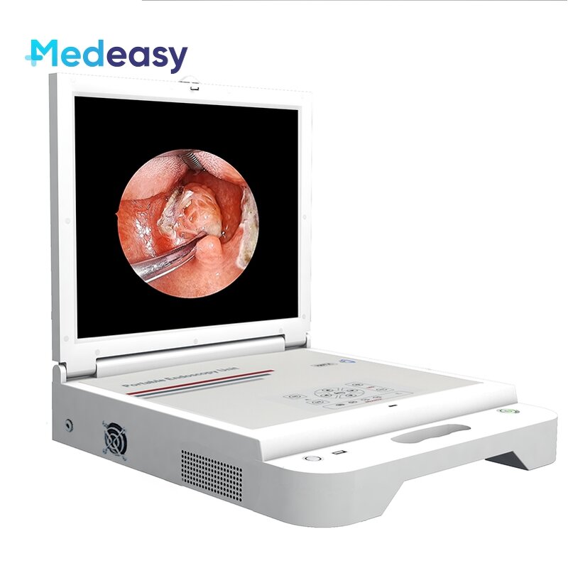Full HD Portable Endoscopy Camera Unit Supplier - System with Monitor Light Recorder
