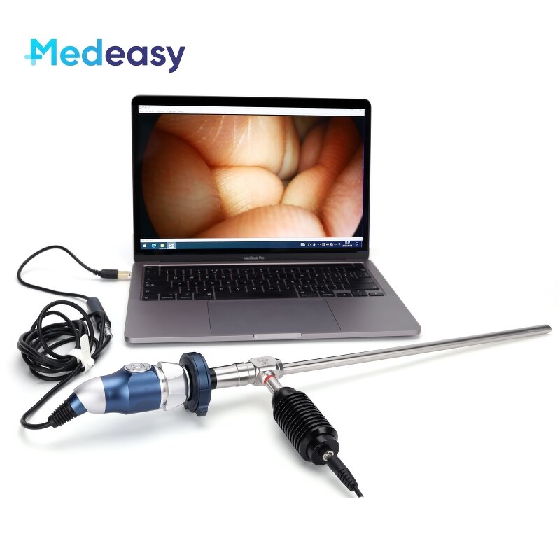 Medical Portable Endoscope Camera Factory - Multi-Display USB HDMI HD 1080P