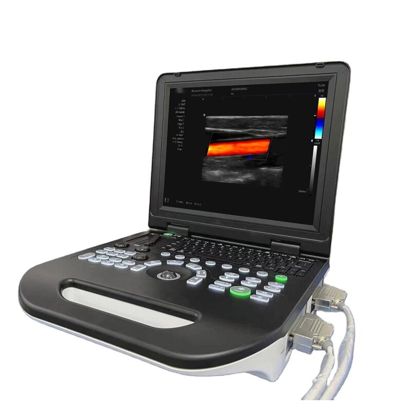 Color Doppler Ultrasound Factory - Portable 3D Image Pregnancy Diagnostic