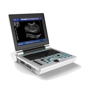 Portable Wireless Ultrasound Manufacturer - Hot Selling Mini 2 in 1 Custom