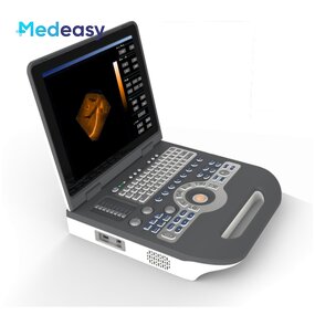 Color Doppler Ultrasound Scanner Supplier - Mindray 4d Portable Attractive Price