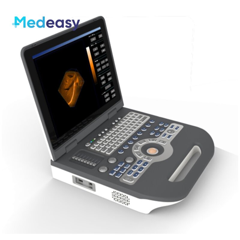 Color Doppler Ultrasound Scanner Supplier - Mindray 4d Portable Attractive Price