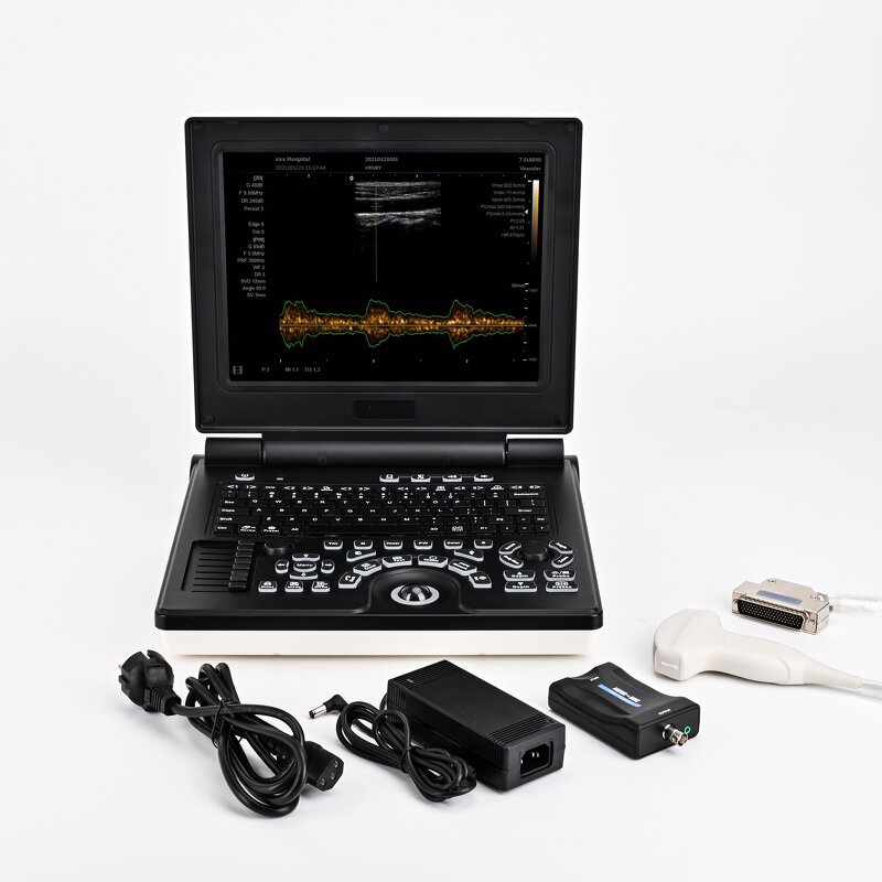 Portable Ultrasound Supplier - New Type Laptop Doppler Test Diagnostic