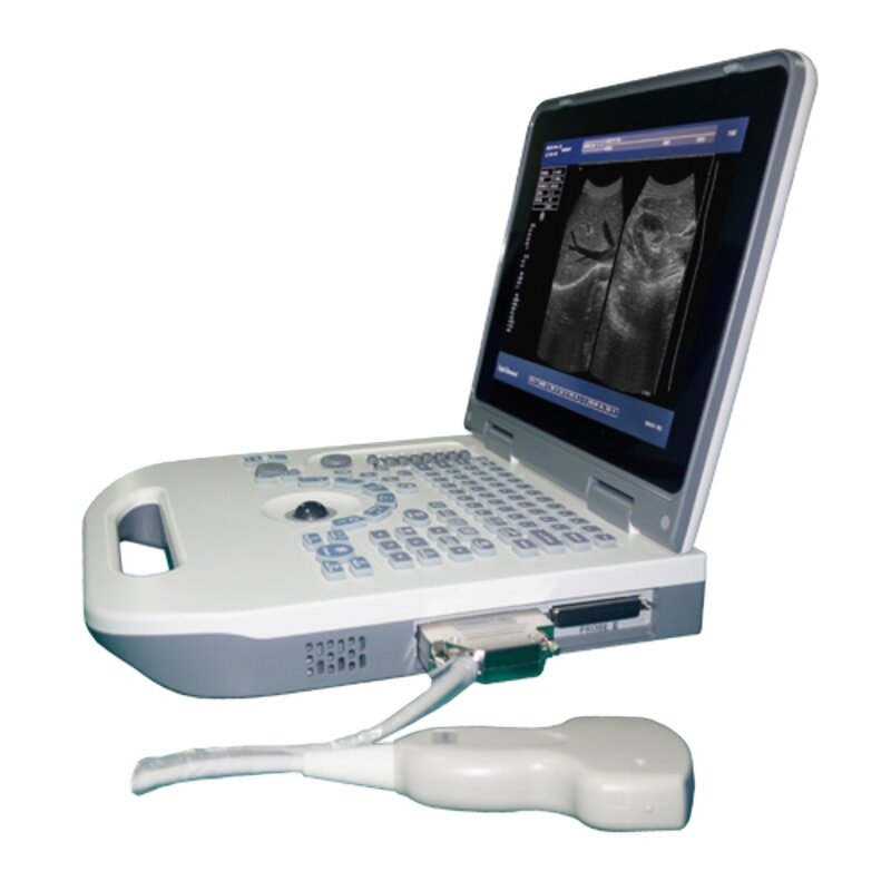 Portable Ultrasound Supplier - Full Digital LED Health Treatment Expert