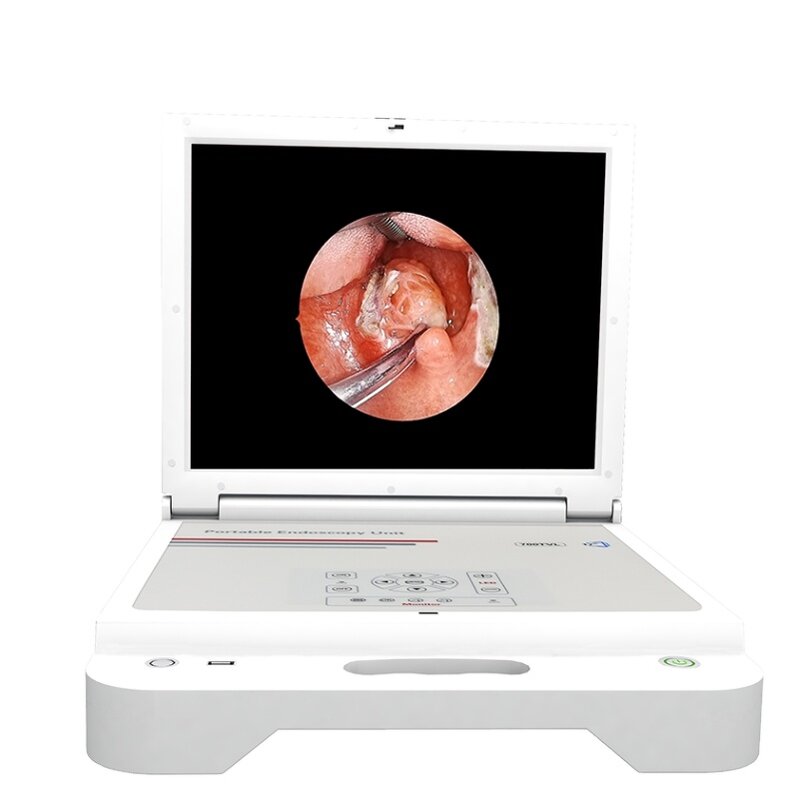 Full HD Portable Endoscopy Camera Unit Supplier - System with Monitor Light Recorder