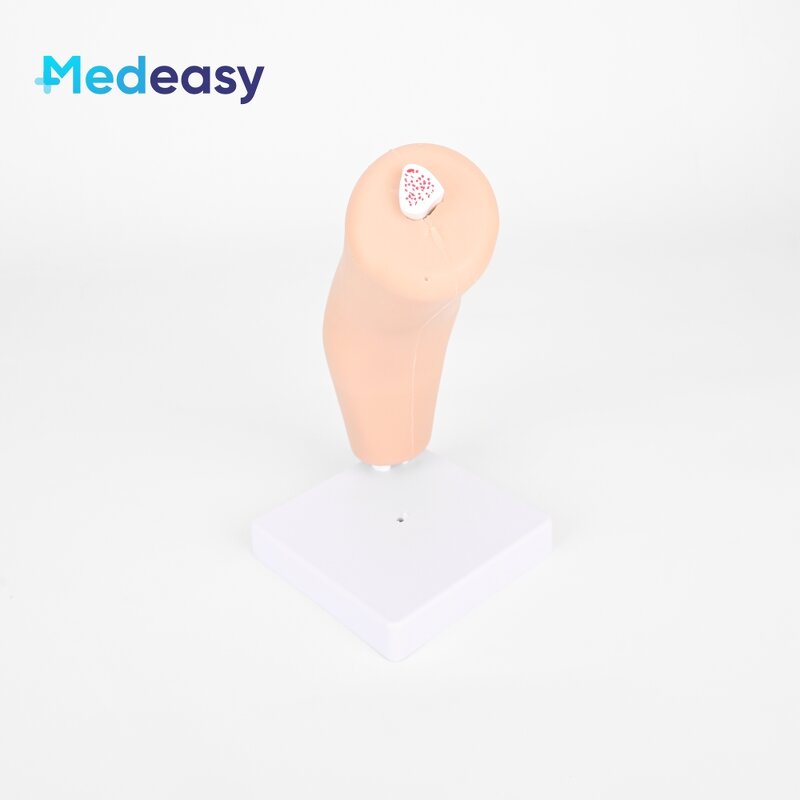 Arthroscopy Simulator Elbow Joint Manufacturer - High Simulation for Surgery Training